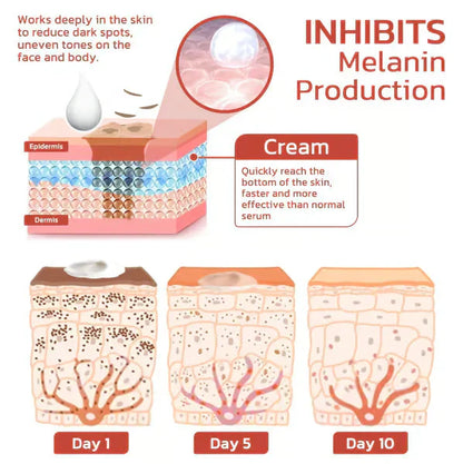 ⚡Anti-Freckle Cream Sale! ⏳🎉