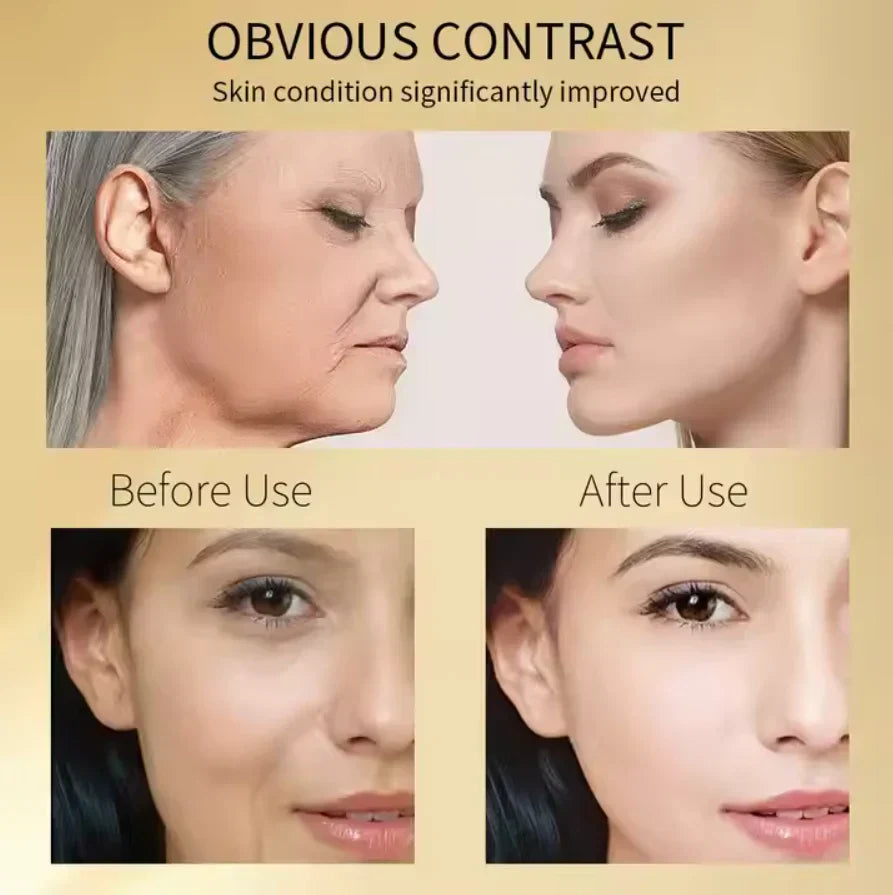 Last Day Of Discount ✨24K Gold Niacinamide Face Serum✨