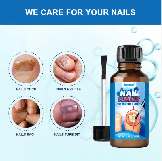 Last Day Of Discount 🔥 Nail Repair & Antifungal Solution