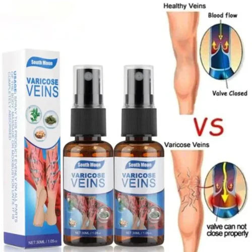 Last Day Of Discount 🔥 Varicose Veins Spray